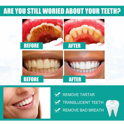 EELHOE Teeth Whitening Powder
