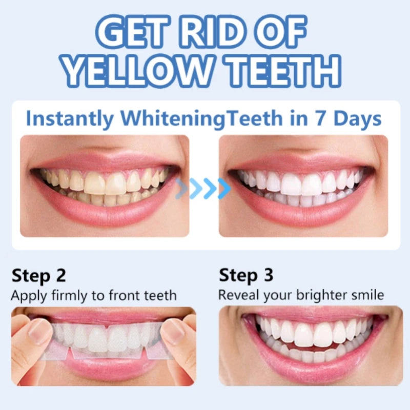 5D Teeth Whitening Strips